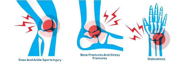 Ortho doctor preventive measures for neck pain, strains, and injuries