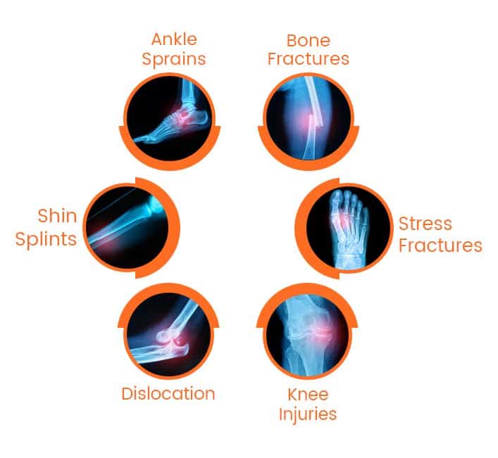 15-Sports-injury-treatment-jpg