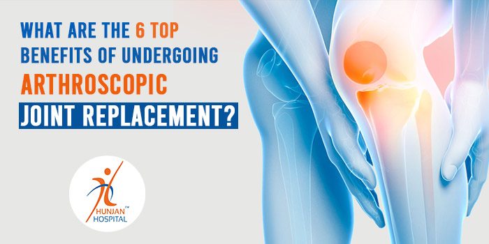 What are the 6 top benefits of undergoing arthroscopic joint replacement?