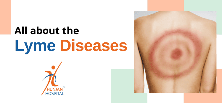 What are Lyme diseases? Why should you visit Hunjan Hospital for its treatment?