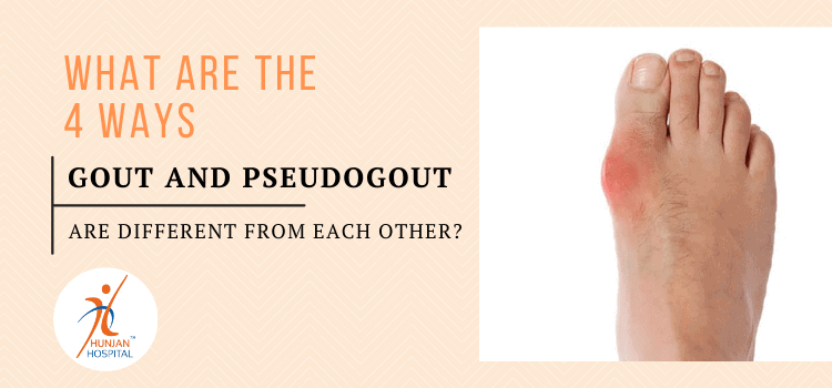 What are the 4 ways gout and pseudogout are different from each other?