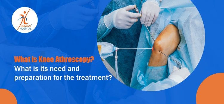 What is knee arthroscopy? What is its need and preparation for the treatment?