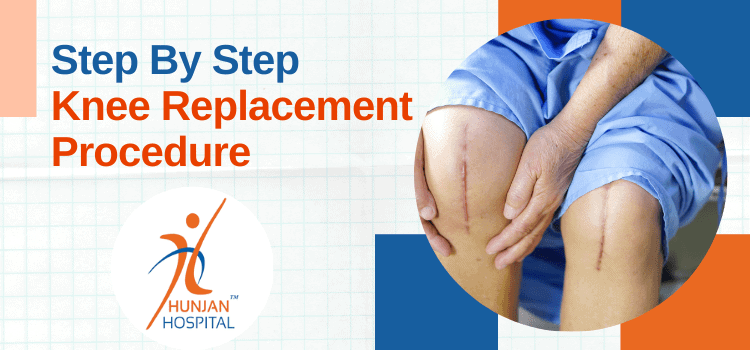 7 Step Knee Replacement Procedure – Carried Out at Hunjan Hospital