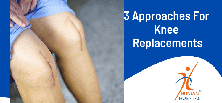 3 Approaches For Knee Replacements