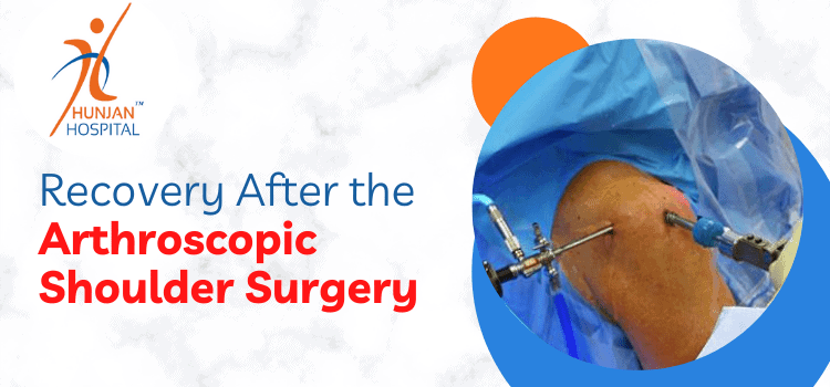 Recovery after the arthroscopic shoulder surgery