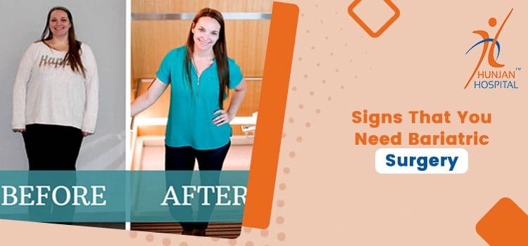 5 significant signs that you are a suitable candidate for bariatric surgery