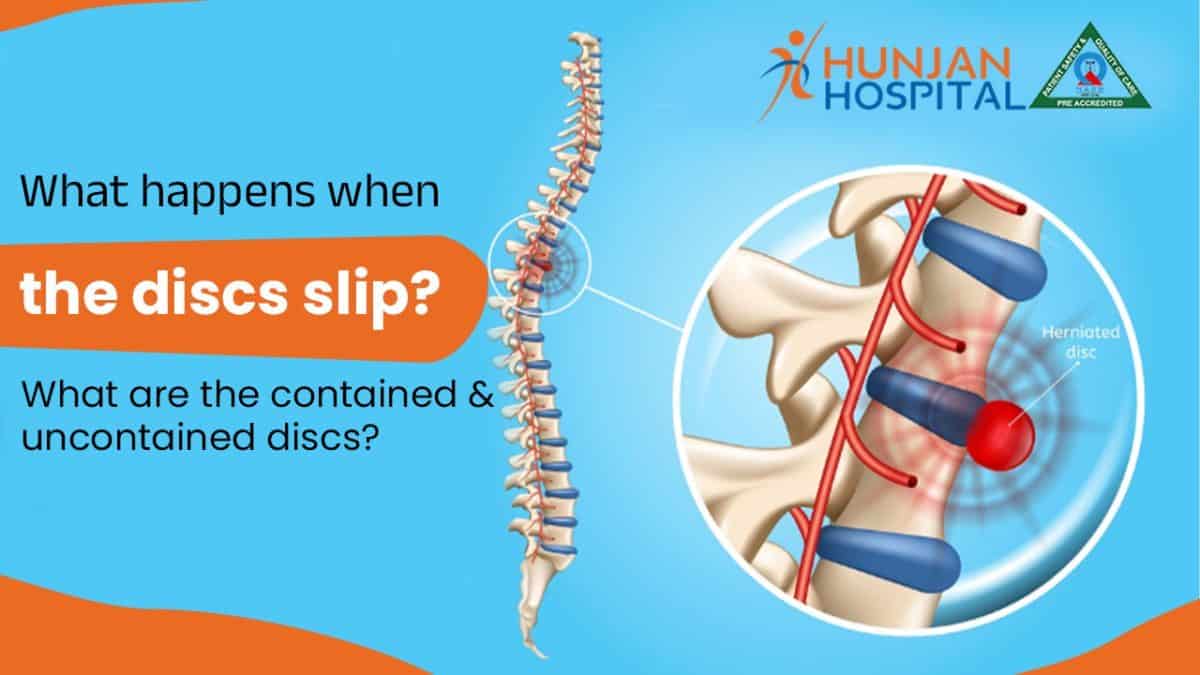 What Happens When the Discs Slip? What are the Contained & Uncontained Discs?