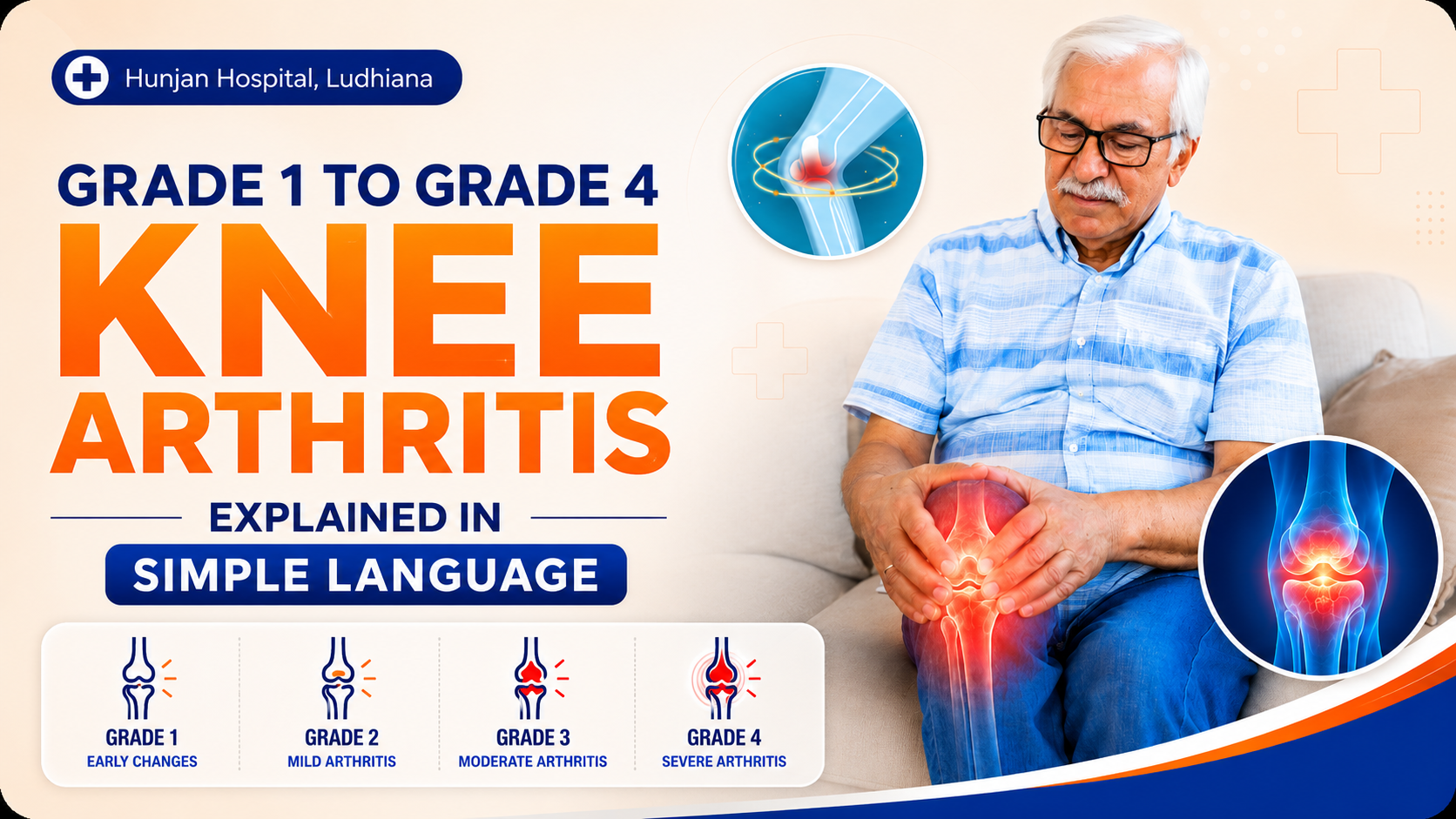 Knee arthritis is a condition where the smooth cartilage inside the knee joint starts wearing down over time. This cartilage normally allows the bones to move smoothly without friction. When it becomes thin or damaged, the movement of the joint is affected, leading to pain, stiffness and difficulty in daily activities.