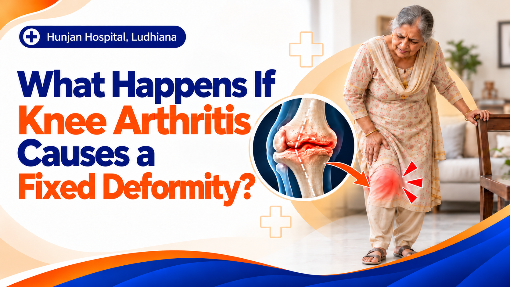 Knee Arthritis and Fixed Deformity