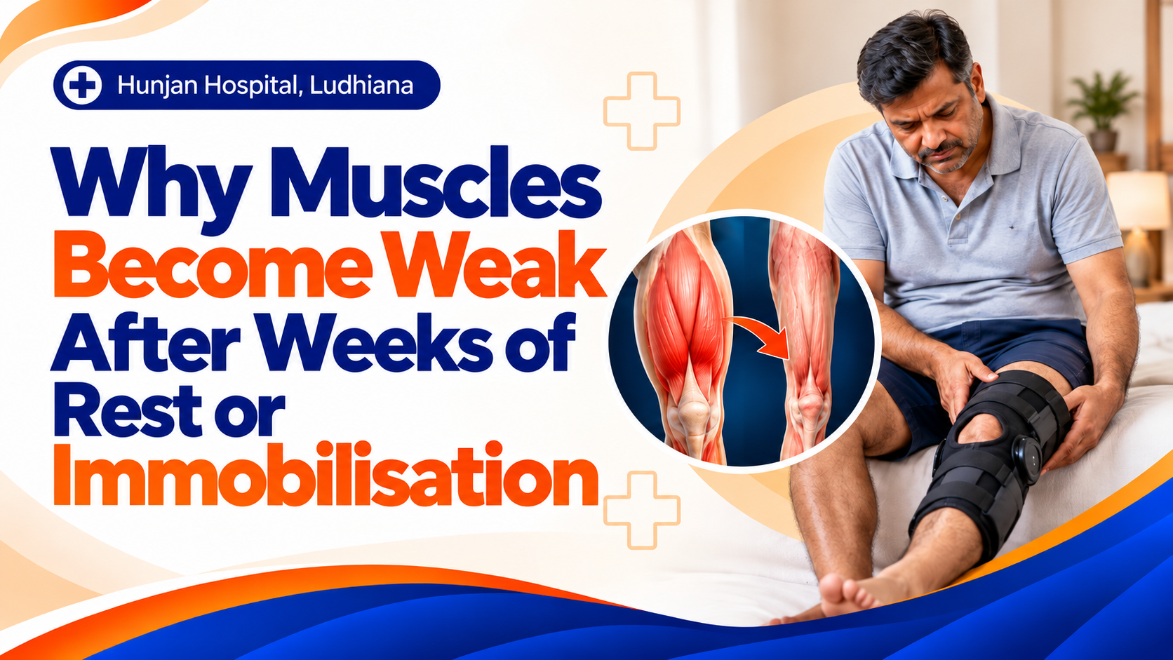 Why Muscles Become Weak After Immobilisation